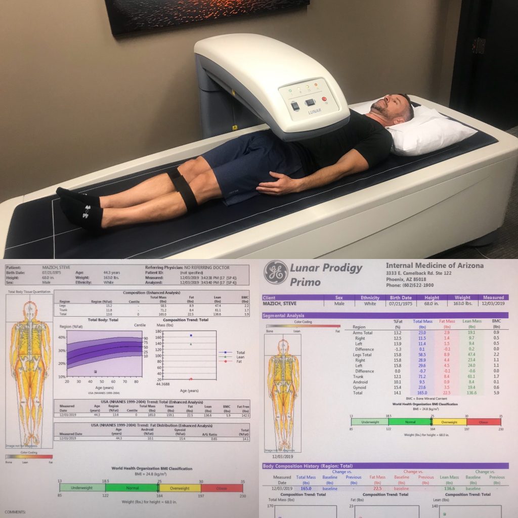 DEXA Scan Example